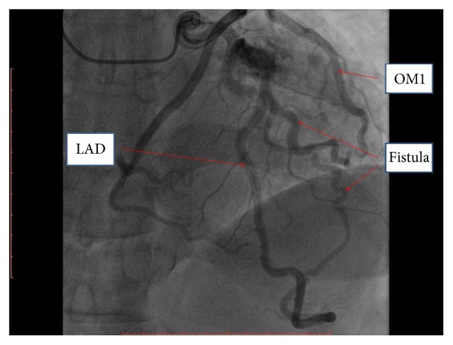 Figure 2