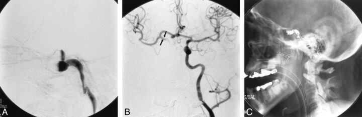 fig 3.