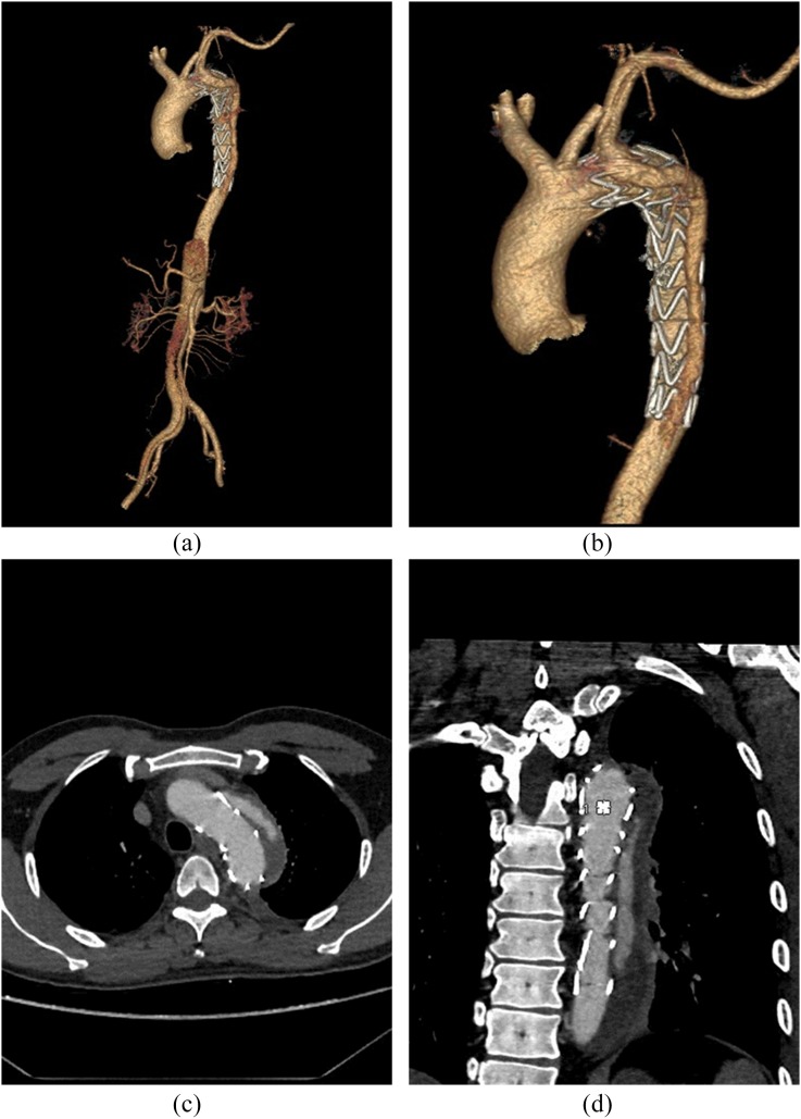 Figure 2.