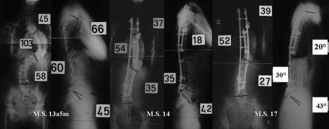 Fig. 1