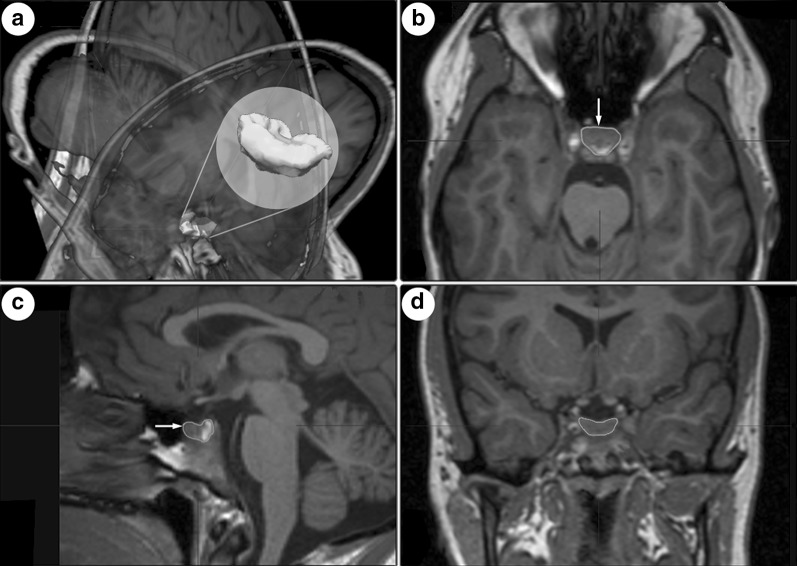 Fig. 1