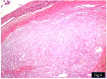 [Table/Fig-4]:
