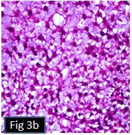 [Table/Fig-3b]: