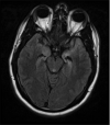 Case 1 Figure