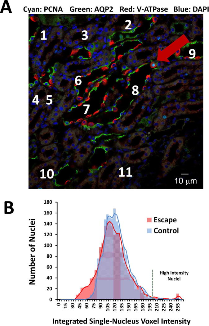 Figure 11