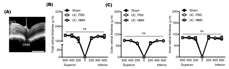 Nicotinamide Mononucleotide Protects Against Retinal Dysfunction In A 