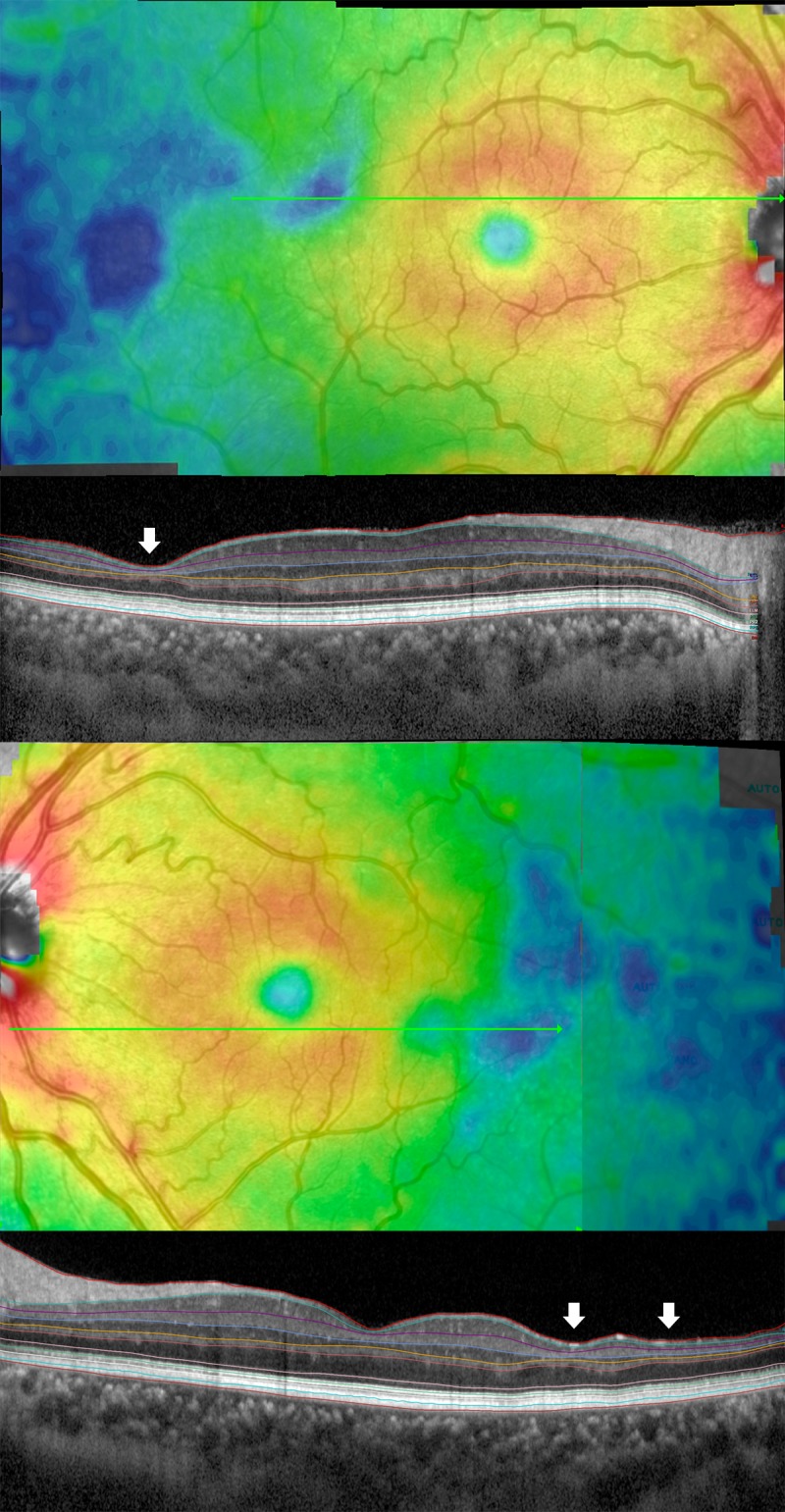 Fig 2