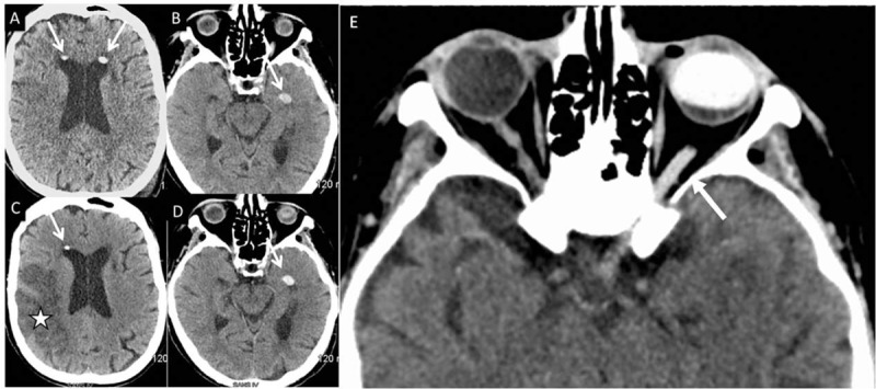 FIGURE 1