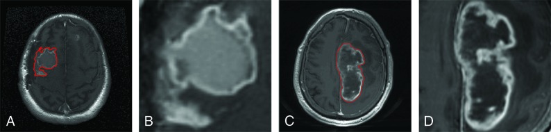 Fig 2.