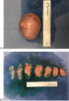 Fig 3 –