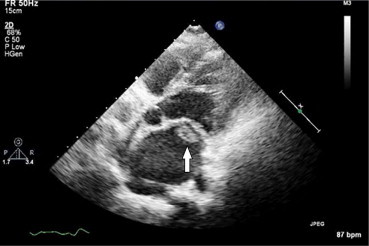 Fig. 3