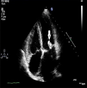 Fig. 1