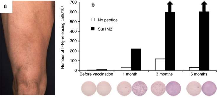 Fig. 2