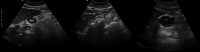 Fig. 11