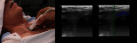 Fig. 12