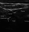 Fig. 10