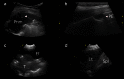 Fig. 17