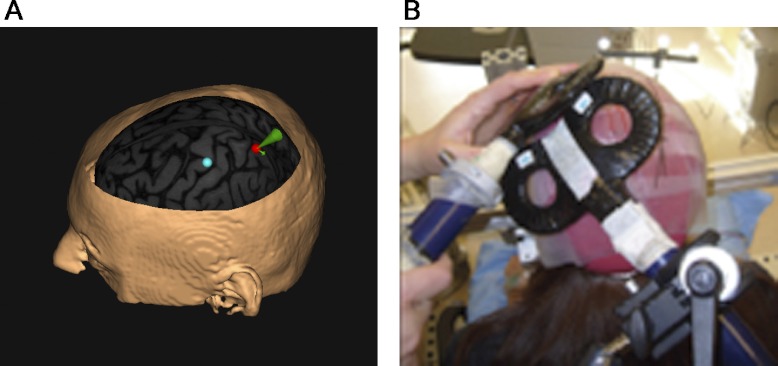 Fig. 2.