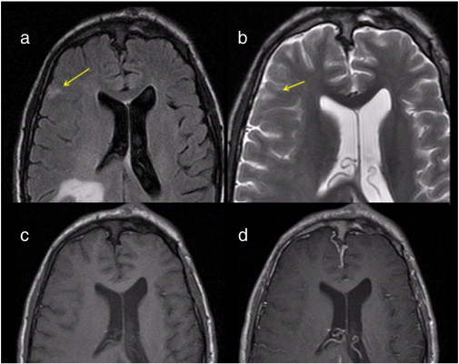 Fig. 5