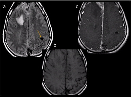 Fig. 6