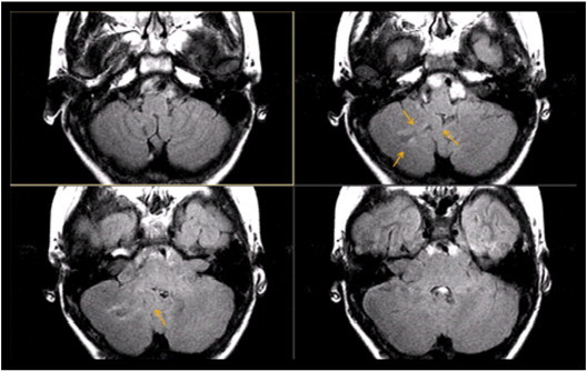 Fig. 7