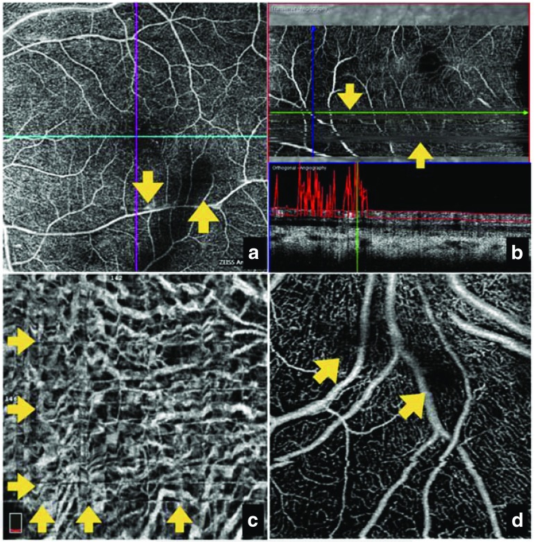 Fig. 4