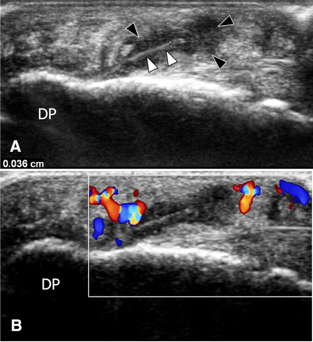 Fig. 30