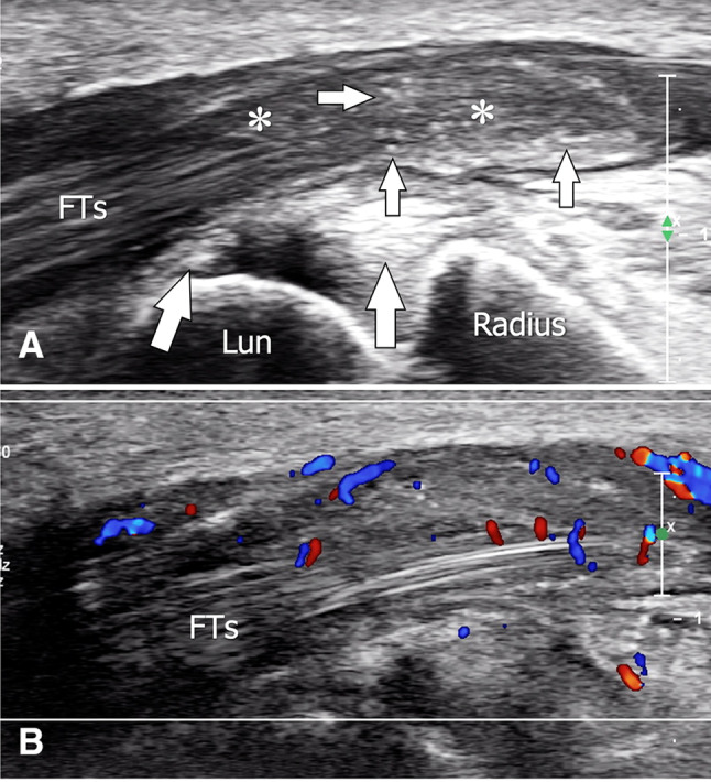 Fig. 17