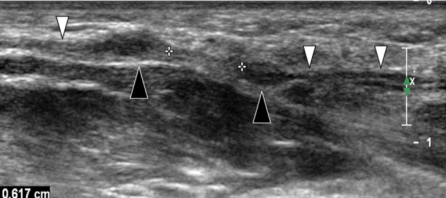 Fig. 12