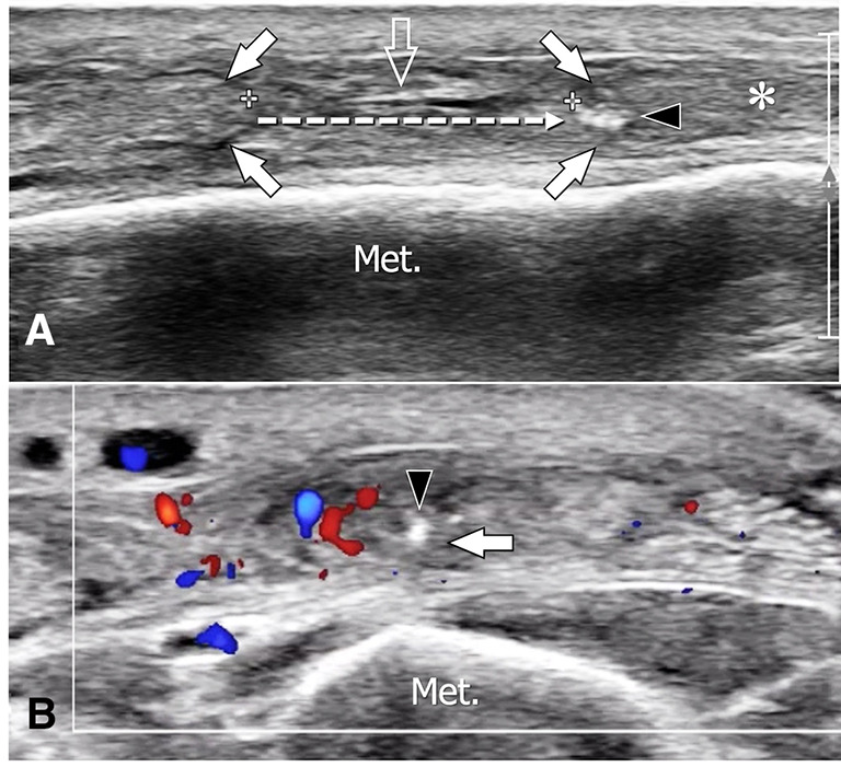 Fig. 21