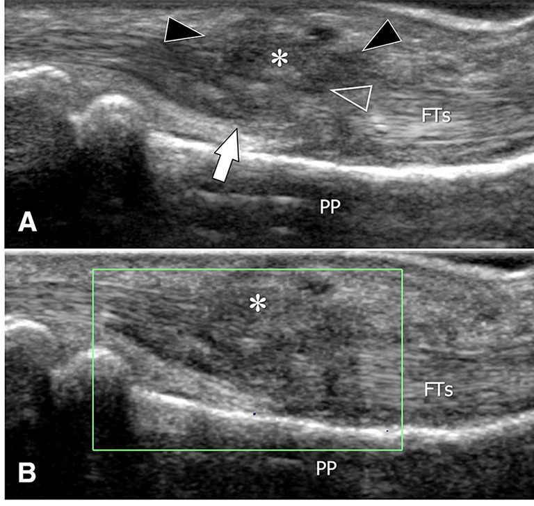 Fig. 18