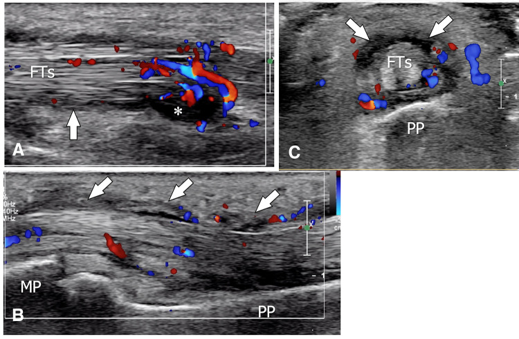 Fig. 14