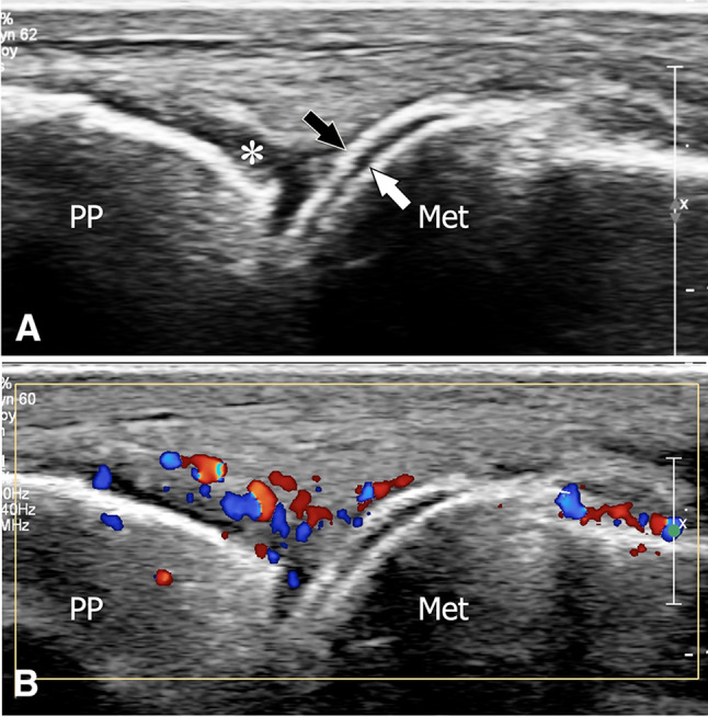 Fig. 16