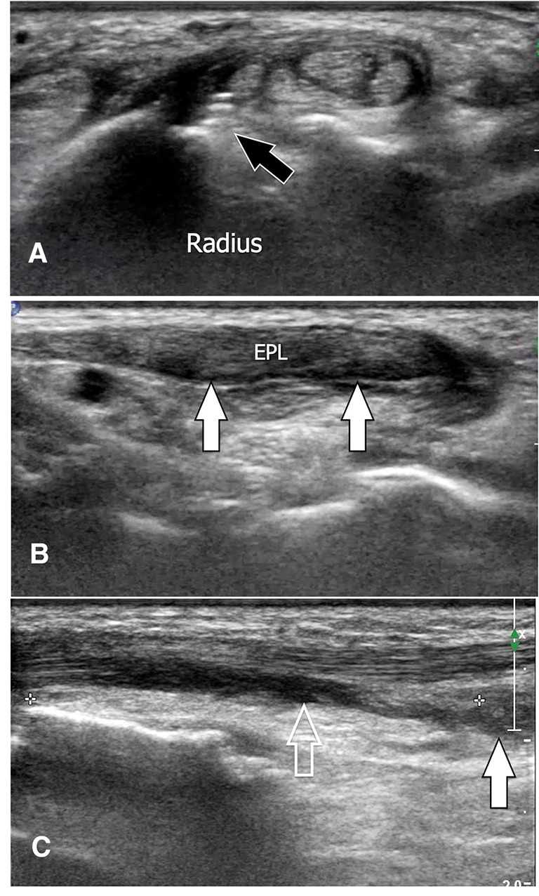 Fig. 26