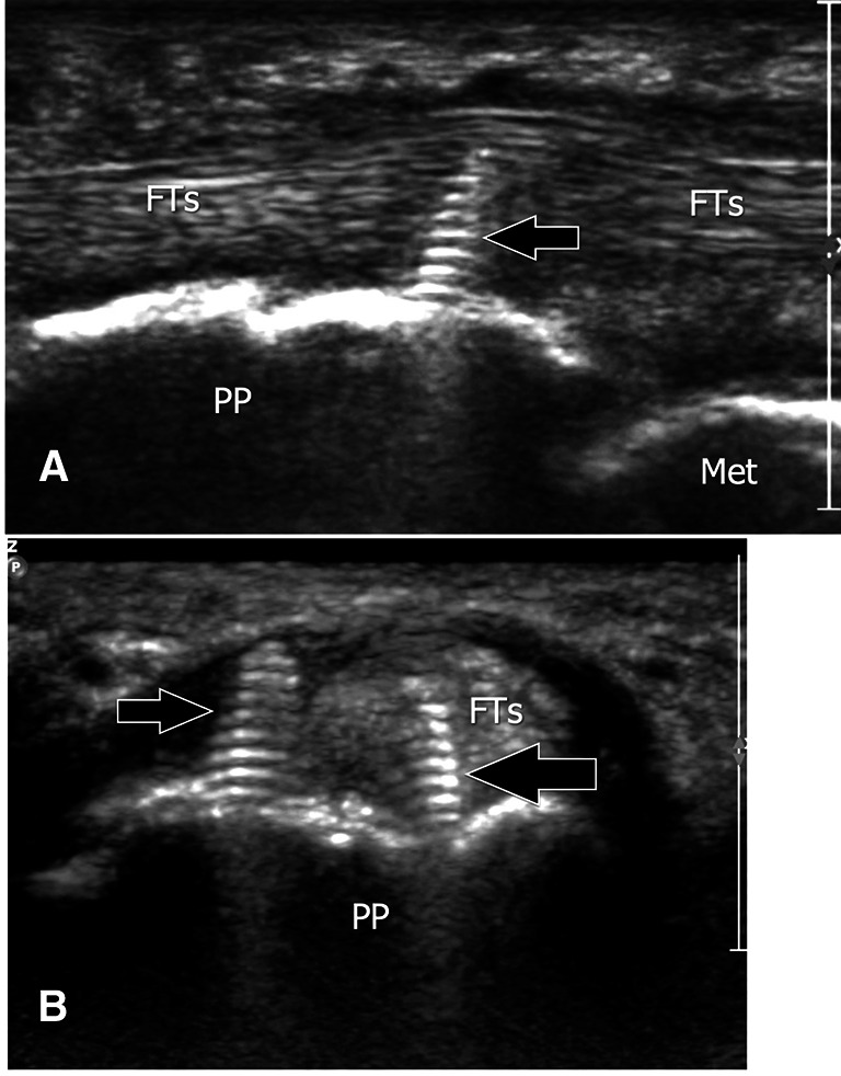 Fig. 22