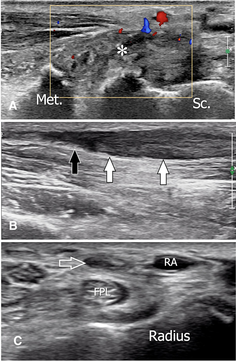 Fig. 19