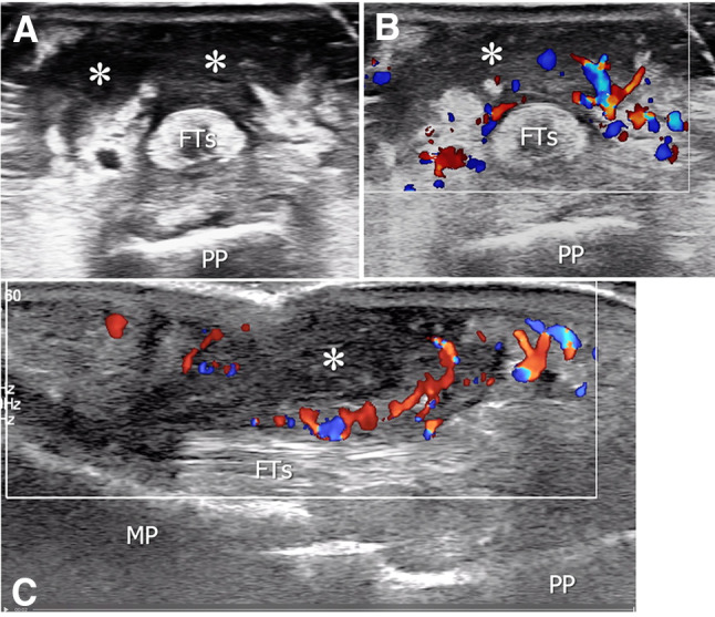 Fig. 15