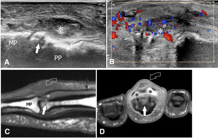 Fig. 13