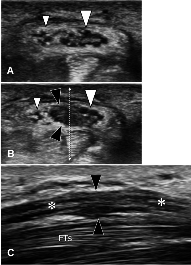 Fig. 11