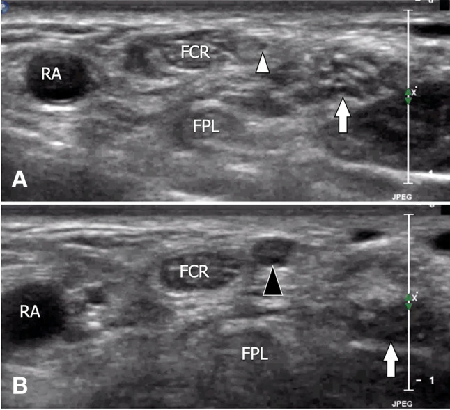 Fig. 10