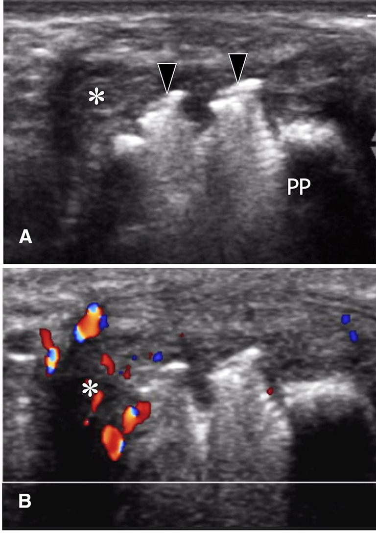 Fig. 23