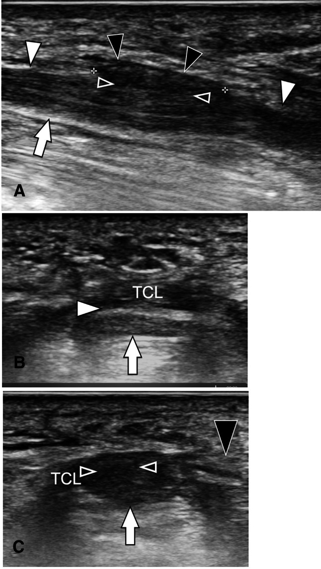 Fig. 9