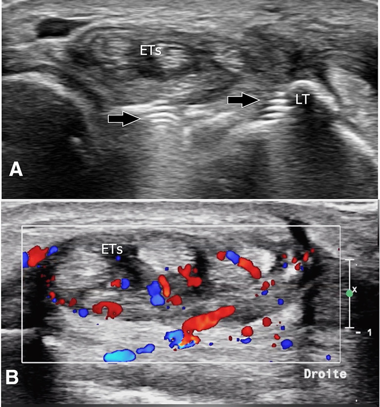 Fig. 24