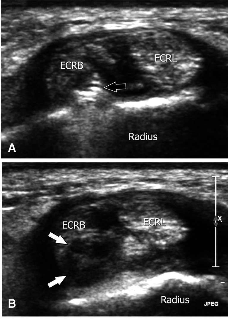 Fig. 25