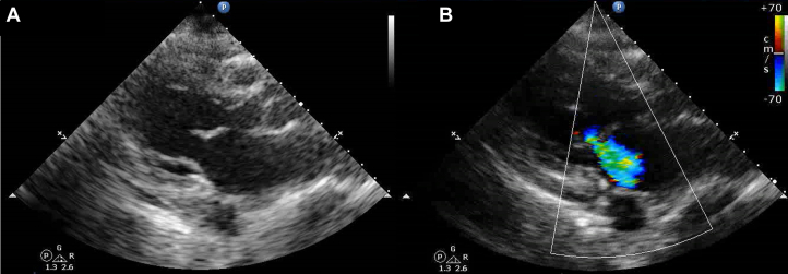 Figure 1