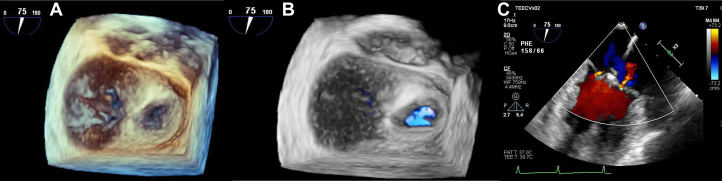 Figure 4