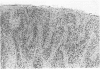 237