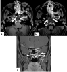 Fig. 15