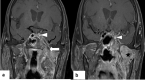 Fig. 17