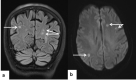 Fig. 11